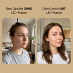 Zymera GlowMask – Licht, das unter die Haut geht